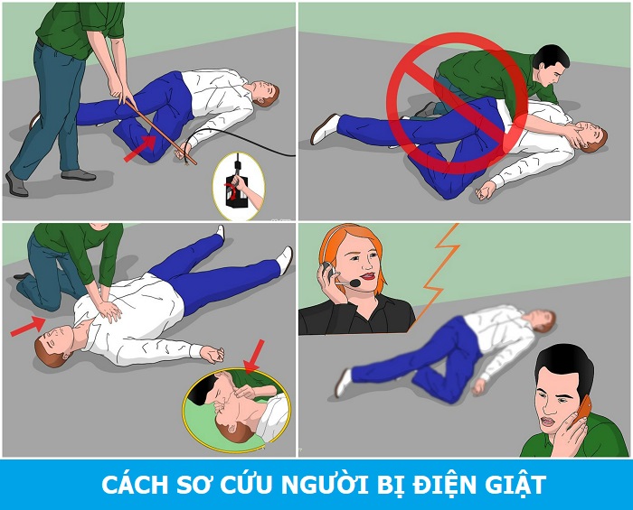 Sơ cứu người bị điện giật